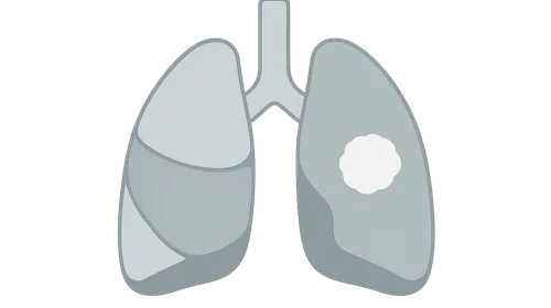 Radiographic Signs in Chest Imaging