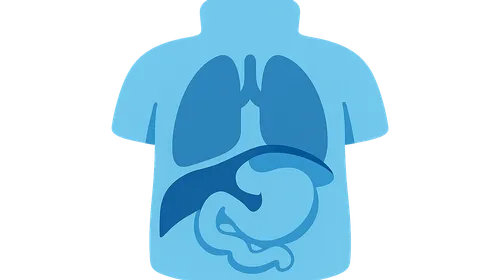 Congenital diaphragmatic hernia