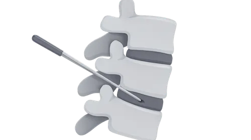 Minimally Invasive Spine Surgery