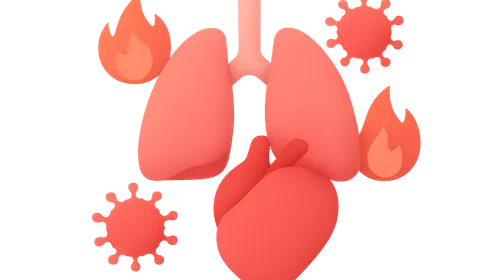 Systemic inflammatory response syndrome
