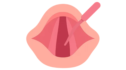 Phonosurgery Techniques