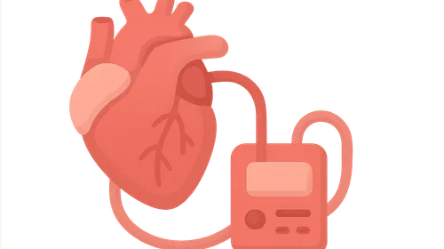 Myocardial Protection Strategies