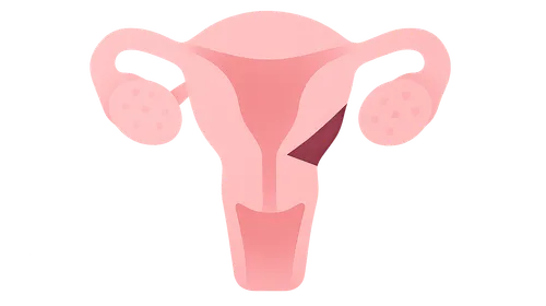 Fertility-preserving surgical techniques