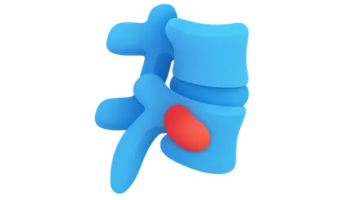 Spondyloarthropathies