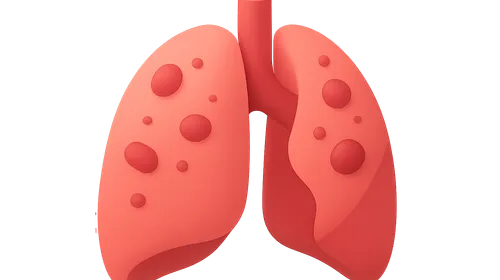 Sepsis and Septic Shock