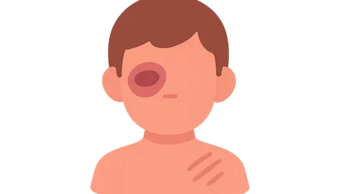 Physical Abuse Recognition