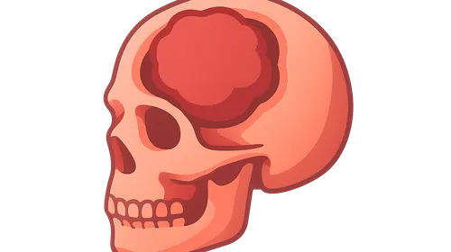 Complications of Skull Base Surgery