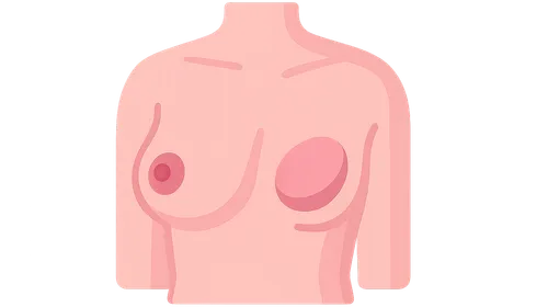 Breast reconstruction options