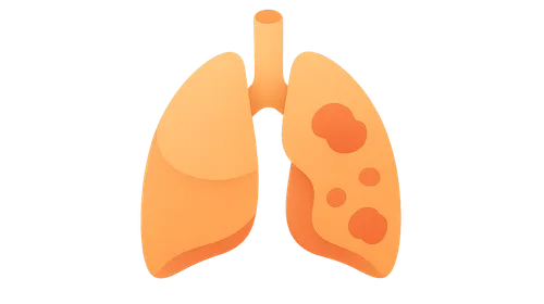 Tuberculosis Control