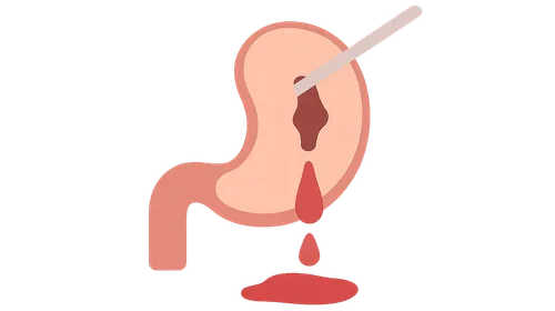 Complications of minimally invasive surgery