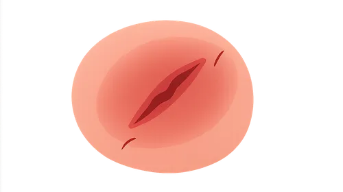 Injuries and Their Significance