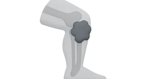 Clinical correlations of lower limb