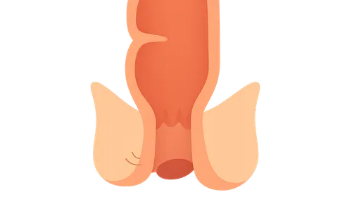 Anorectal Malformations