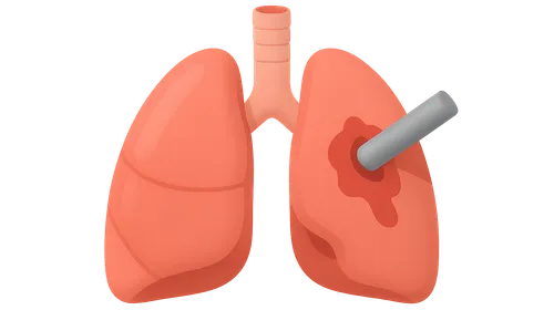 Chest Trauma Management