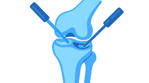 Therapeutic Arthroscopic Procedures