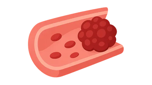 Biochemistry of Hemostasis