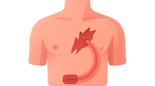 Chest trauma management