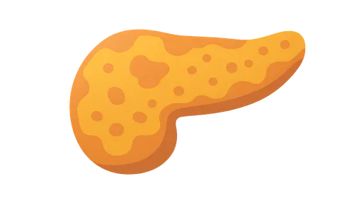 Diagnosis of chronic pancreatitis