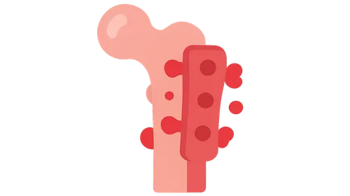 Implant-Related Infections