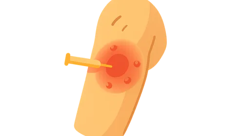 Adverse Events Following Immunization