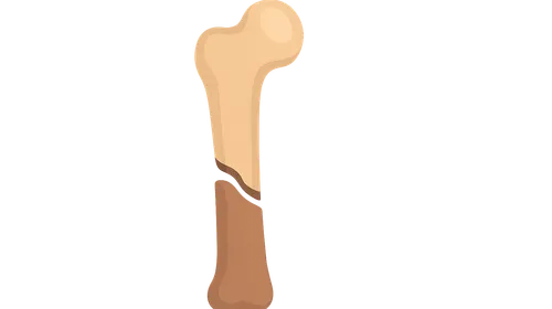 Fracture classification and management principles