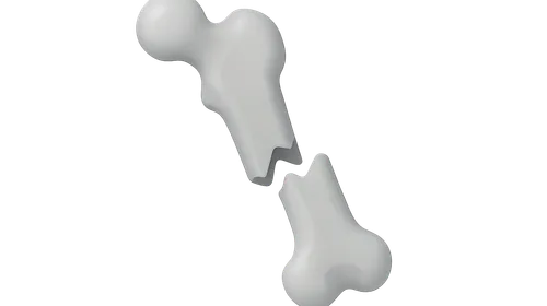 Imaging of Fractures and Dislocations