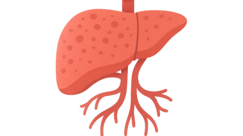Cirrhosis and Portal Hypertension