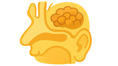 Biofilms in otitis media and sinusitis