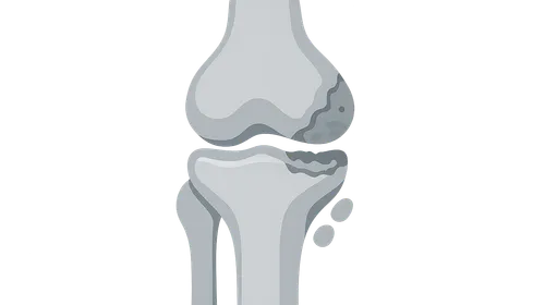 Joints and Rheumatologic Diseases