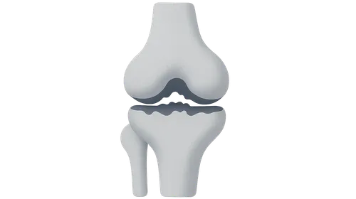 Osteoarthritis of Knee