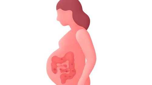 IBD in pregnancy