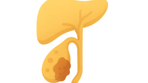 Biliary Tract Disorders
