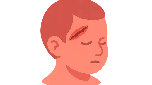 Pediatric trauma considerations