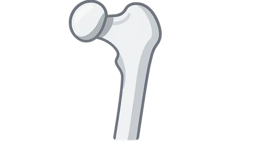 Slipped Capital Femoral Epiphysis