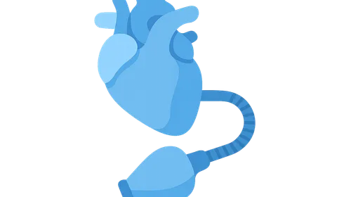 Fast-Track Cardiac Anesthesia