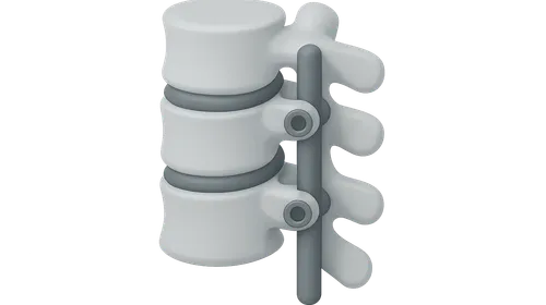 Spinal surgery fundamentals