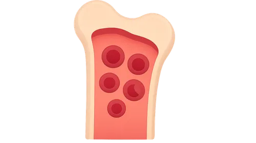 Myelodysplastic Syndromes