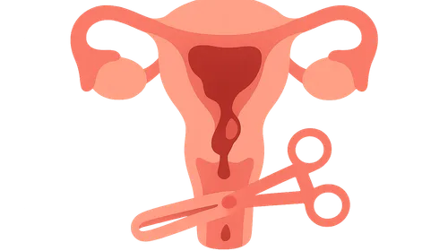 Surgical management of PPH