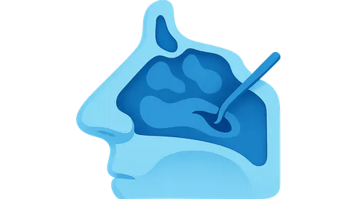 Revision Sinus Surgery