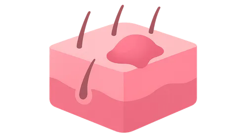 Principles of Diagnosis in Dermatology