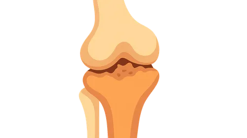 Degenerative Disorders