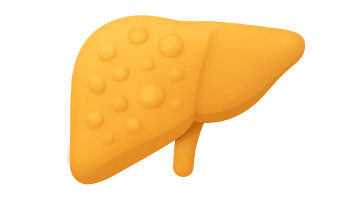 Disorders of lipid metabolism