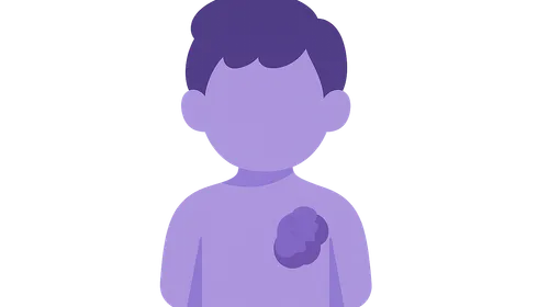 Cancer predisposition syndromes