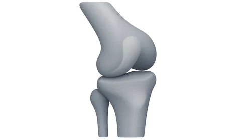 Radiographic Anatomy of Bones and Joints