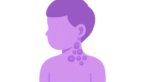 Lymphomas in pediatric population