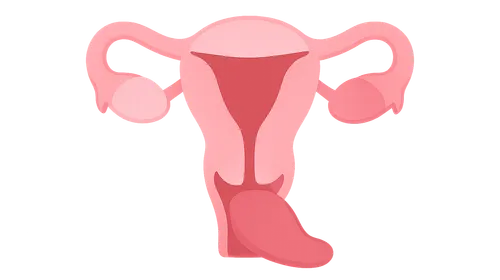 Pelvic Organ Prolapse