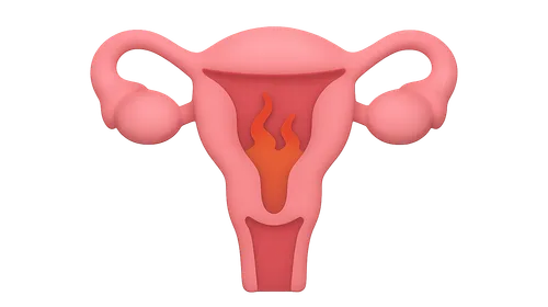 Primary Dysmenorrhea