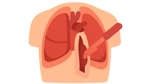 Resuscitative thoracotomy