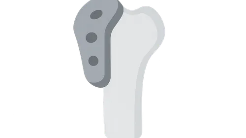 Orthopaedic Biomaterials