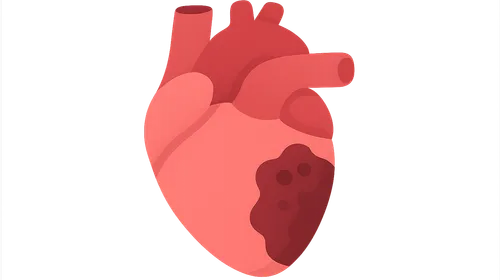 Cardiac cycle in pathologic states
